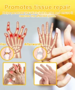 LOTMAY® Joint Freedom Formula Cream