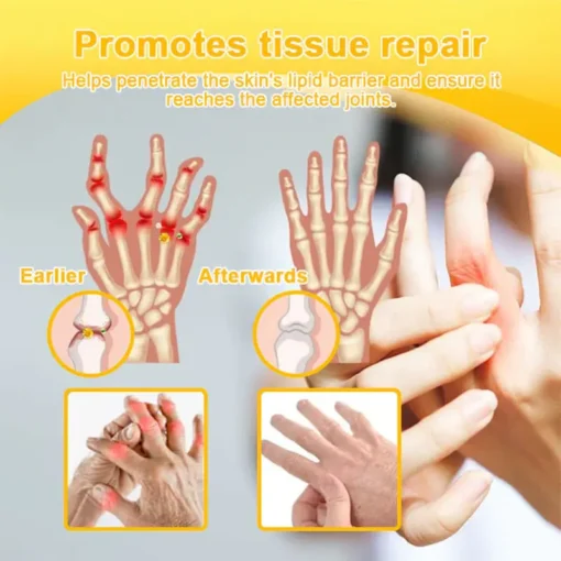 LOTMAY® Joint Freedom Formula Cream