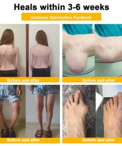 LOTMAY® Joint Freedom Formula Cream