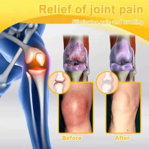 LOTMAY® Joint Freedom Formula Cream