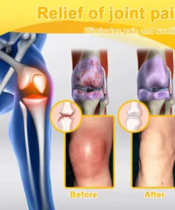Lotmay® Bee Venom Analgesic Bone Repair Cream