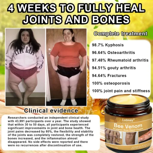 Lotmay® Bee Venom Analgesic Bone Repair Cream