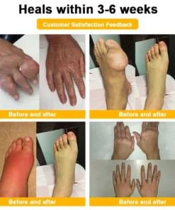 Lotmay® Bee Venom Analgesic Bone Repair Cream