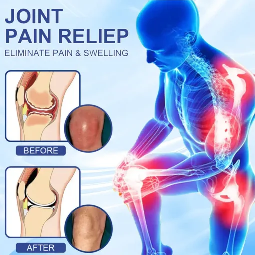 lotmay® Menthol & Emu Oil Joint Pain-Relief Bone Healing Gel