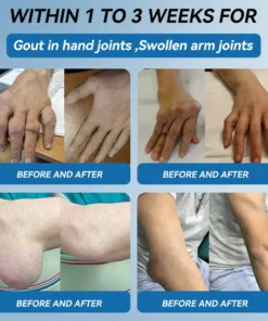 LOTMAY® BPC-157 Joint & Muscle Treatment Cream