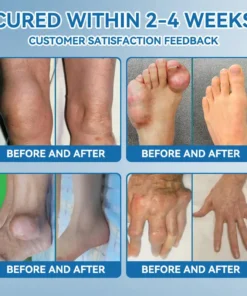 LOTMAY® BPC-157 Joint & Muscle Treatment Cream