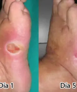 𝙇𝙊𝙏𝑴𝘼𝒀® 𝑮𝙇𝑷-𝟭 𝗠𝐮𝐥𝘁𝗶-𝗔𝗰𝐭𝗶𝗼𝐧 𝗢𝗿𝗮𝗹 𝗔𝗺𝐩𝗼𝘂𝗹𝗲𝐬