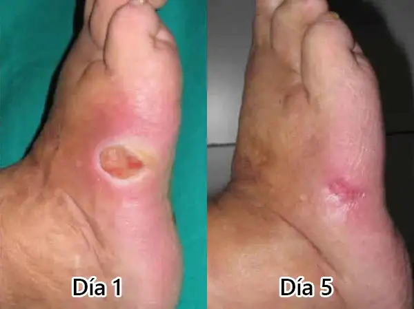 𝙇𝙊𝙏𝑴𝘼𝒀® 𝑮𝙇𝑷-𝟭 𝗠𝐮𝐥𝘁𝗶-𝗔𝗰𝐭𝗶𝗼𝐧 𝗢𝗿𝗮𝗹 𝗔𝗺𝐩𝗼𝘂𝗹𝗲𝐬