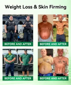 𝐋𝐨𝐭𝐦𝐚𝐲® 𝐓𝐢𝐫𝐳𝐞𝐩𝐚𝐭𝐢𝐝𝐞 𝐆𝐋𝐏-𝟏 × 𝐆𝐈𝐏 𝟏𝟎-𝐢𝐧-𝟏 𝑯𝒆𝒓𝒃𝒂𝒍 𝑯𝒆𝒂𝒍𝒕𝒉 𝑶𝒓𝒂𝒍 𝑺𝒐𝒍𝒖𝒕𝒊𝒐𝒏