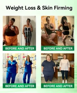 ๐๐จ๐ญ๐ฆ๐๐ฒยฎ ๐๐ข๐ซ๐ณ๐๐ฉ๐๐ญ๐ข๐๐ ๐๐๐-๐ ร ๐๐๐ ๐๐-๐ข๐ง-๐ ๐ฏ๐๐๐๐๐ ๐ฏ๐๐๐๐๐ ๐ถ๐๐๐ ๐บ๐๐๐๐๐๐๐