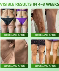 ๐๐๐๐ฆ๐๐ฒยฎ ๐
๐ข๐ซ๐ฆ๐ข๐ง๐ & ๐๐ง๐ญ๐ข-๐๐ซ๐ข๐ง๐ค๐ฅ๐ ๐๐ญ๐๐ฆ ๐๐๐ฅ๐ฅ ๐๐จ๐ฅ๐ฅ๐๐ ๐๐ง ๐๐ซ๐จ๐ฉ๐ฌ